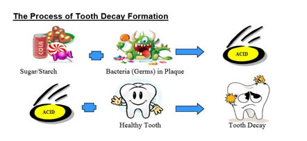 How cavities form
